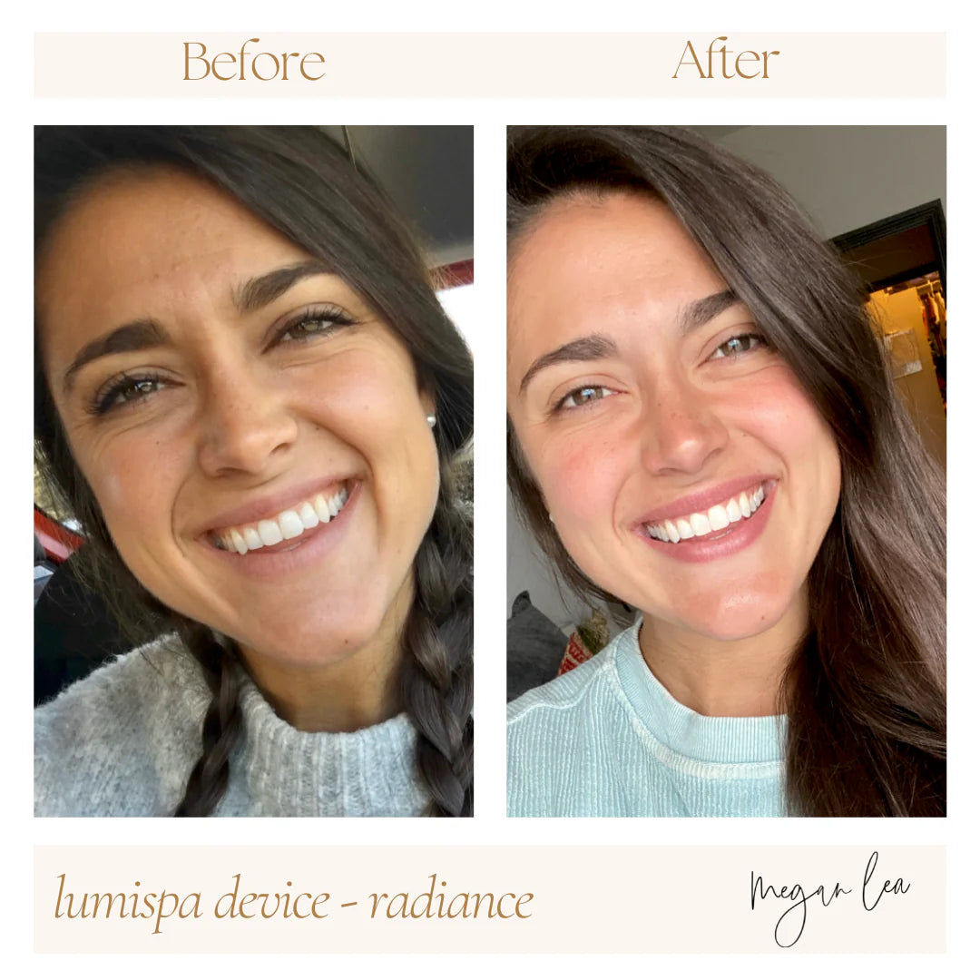 ageLOC Rose Gold LumiSpa® iO