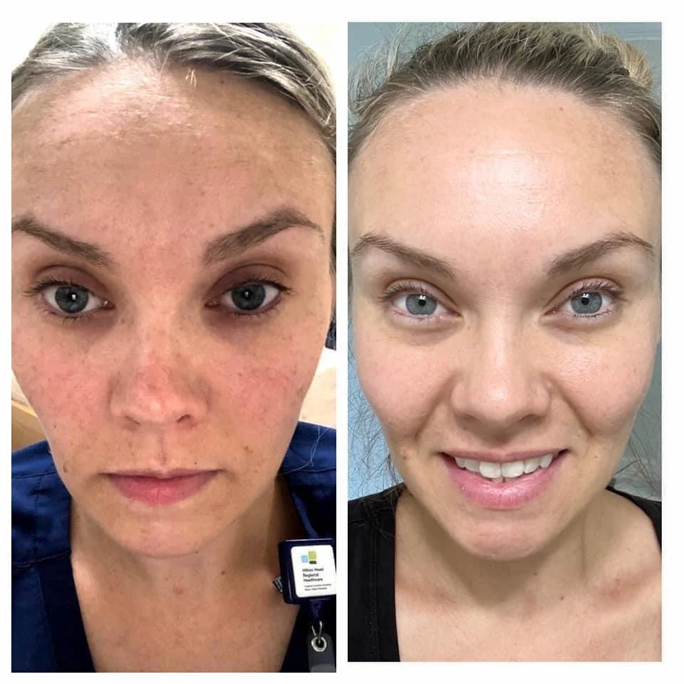 BEAUTY FOCUS COLLAGEN