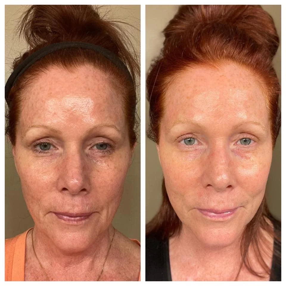 BEAUTY FOCUS COLLAGEN