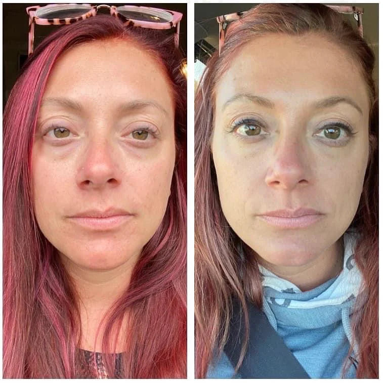 BEAUTY FOCUS COLLAGEN
