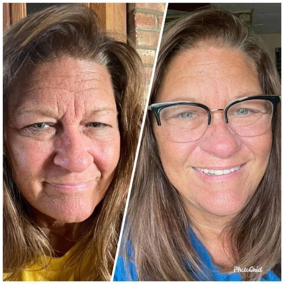 BEAUTY FOCUS COLLAGEN
