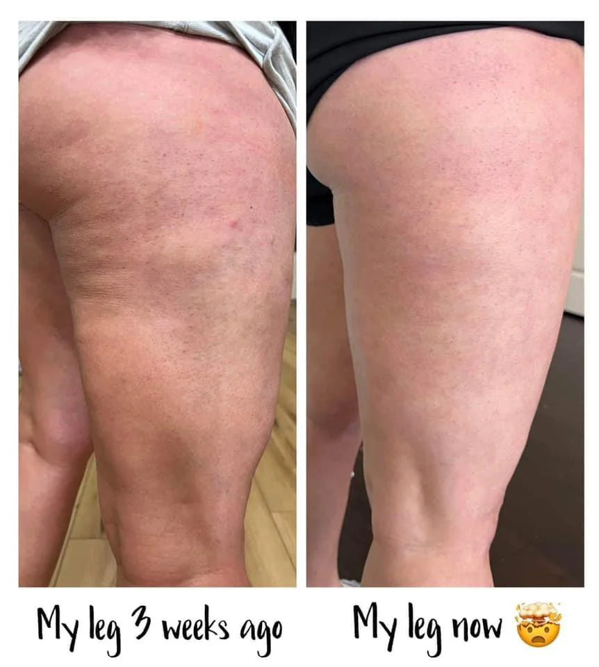 Nu Skin® RenuSpa iO™