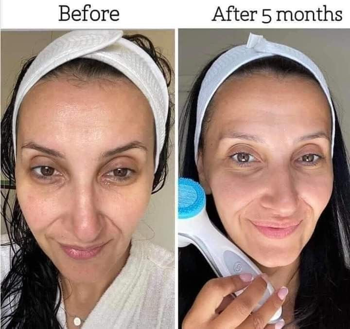 ageLOC Rose Gold LumiSpa® iO