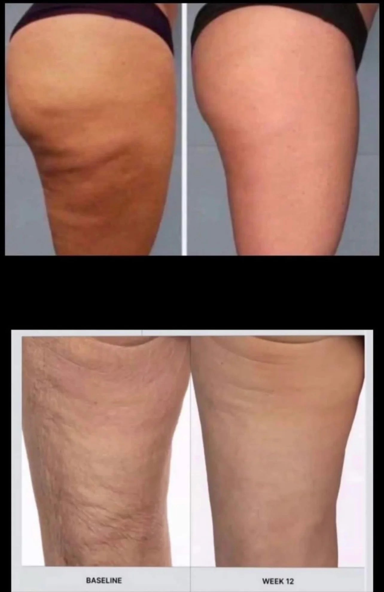 Nu Skin® RenuSpa iO™